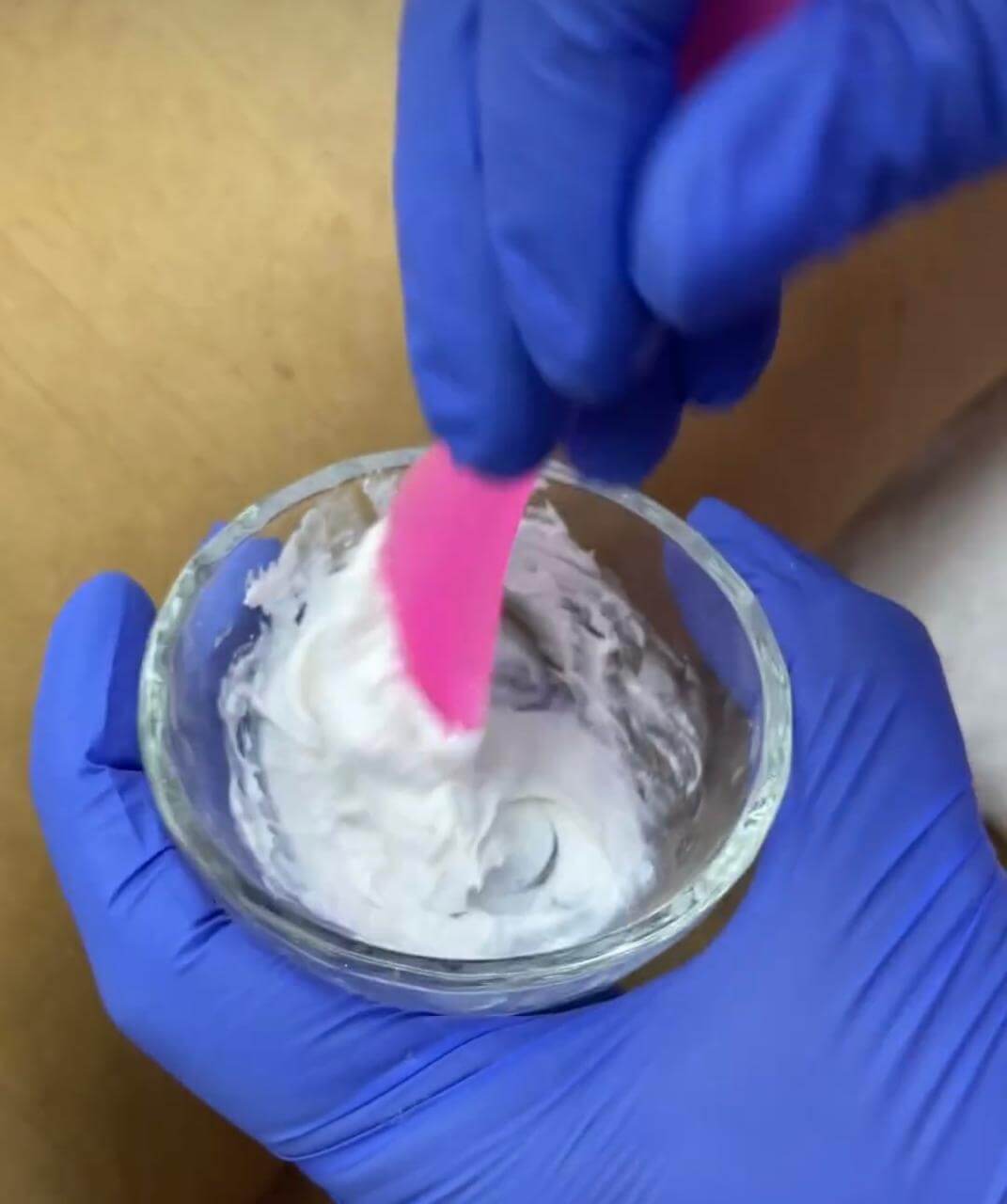 Limpieza Profunda de Espalda (Acné)